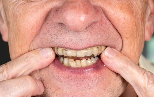 Close-up d'un homme avec un gardien de nuit dans la bouche