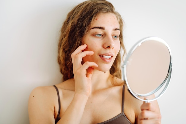 Close-up d'une jolie femme avec des problèmes de peau qui se regarde dans le miroir Dermatologie concept allergie