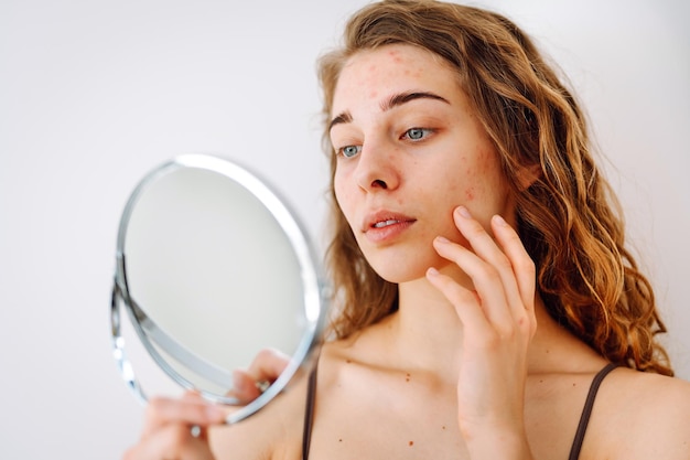 Close-up d'une jolie femme avec des problèmes de peau qui se regarde dans le miroir Dermatologie concept allergie