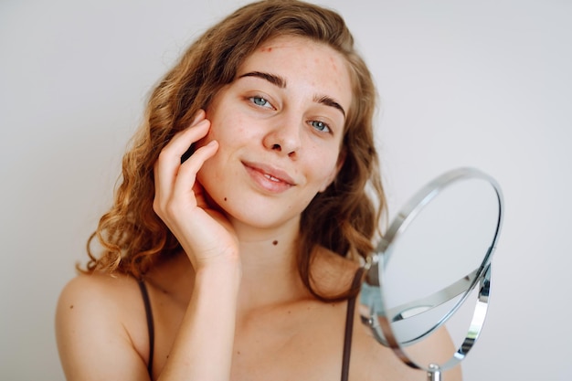 Photo close-up d'une jolie femme avec des problèmes de peau qui se regarde dans le miroir dermatologie concept allergie