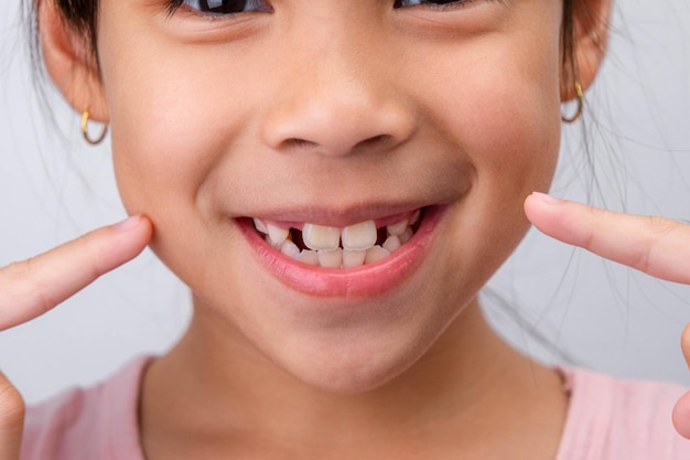 Close-up d'une jolie jeune fille souriante montrant un espace vide avec la croissance des premières dents avant Une petite fille avec un grand sourire et des dents de lait manquantes Concept d'hygiène dentaire