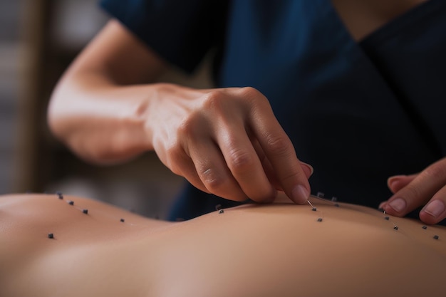 Close-up des mains d'un masseur faisant un massage du dos Close-up d'une thérapeute traitant un patient avec l'acupuncture chinoise générée par IA