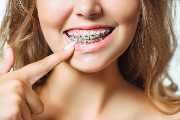 Close-up portrait of young cheerful readhead woman at orthodontist