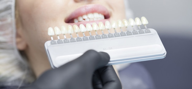 Close up portrait of Young women in dentist chair, Vérifiez et sélectionnez la couleur des dents. Le dentiste fait le processus de traitement dans le bureau de la clinique dentaire.