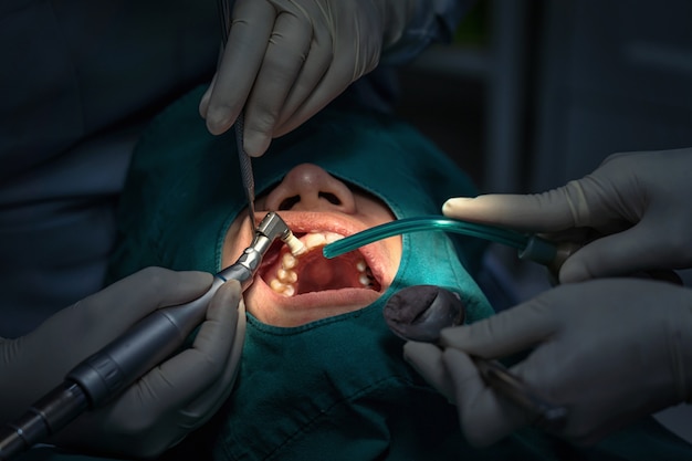 Photo closeup dentiste et assistant opérant pour la vérification et le nettoyage des dents à la clinique dentaire