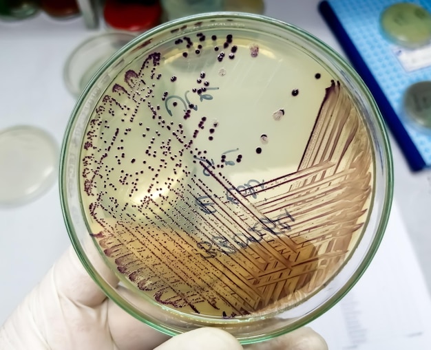Colonie de bactéries d'Escherichia coli ou d'Ecoli dans une plaque de milieu de culture