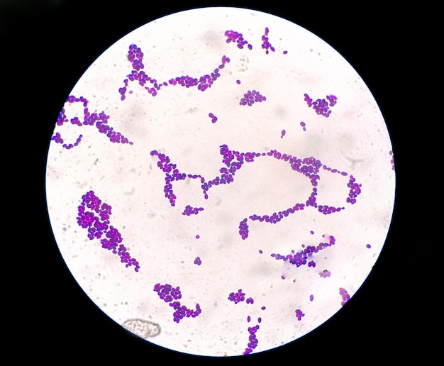 Colonie de Candida sous vue microscopique ou infection par le champignon Candida albicans