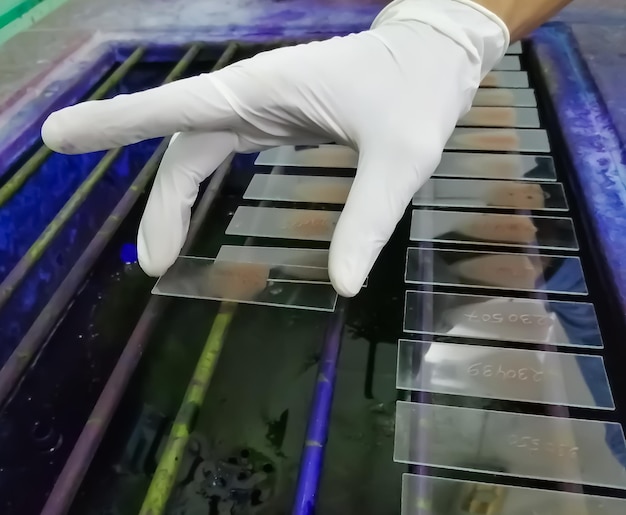 Coloration de lame hématologique par un technicien