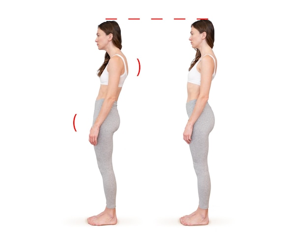 Comparation des problèmes de bonne et de mauvaise posture de la courbure inclinée de la colonne vertébrale