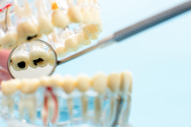 Comparez le modèle de dent et le modèle de dent avec le fil métallique dentaire