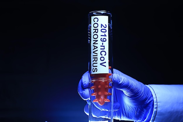 concept coronavirus 2019-ncov, test de risque biologique in vitro de virus