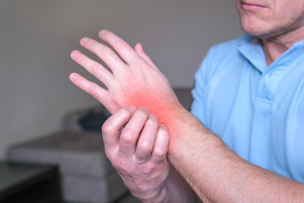 Photo le concept de dermatite eczéma allergies psoriasis un homme se grattant une main qui démange gros plan d'un homme avec une éruption cutanée qui démange sur son bras la zone touchée est surlignée en rouge