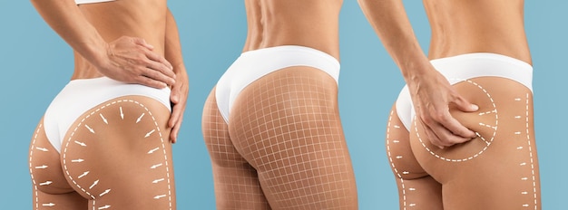 Concept de lipolyse fesses féminines parfaites avec des lignes et des mailles de levage dessinées