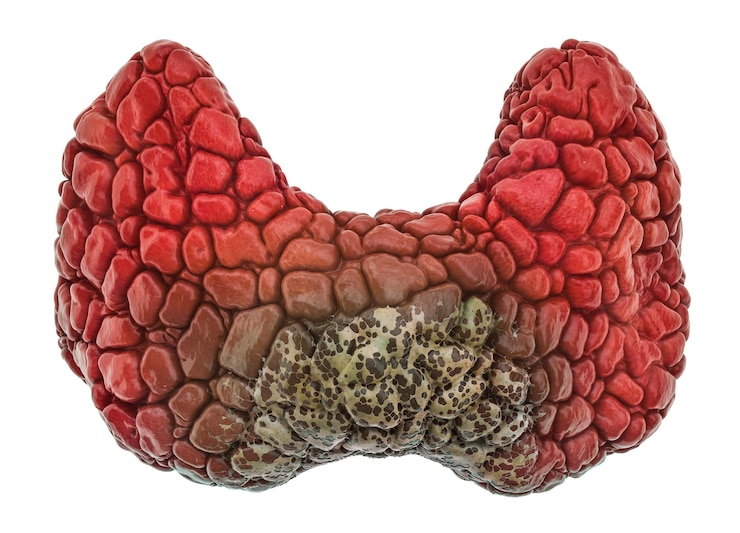 Photo le concept de la maladie de la thyroïde la thyroïde humaine à l'intérieur du piège à ours rendering 3d