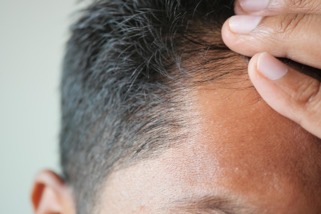 Concept de perte de cheveux avec l'homme vérifiant ses cheveux