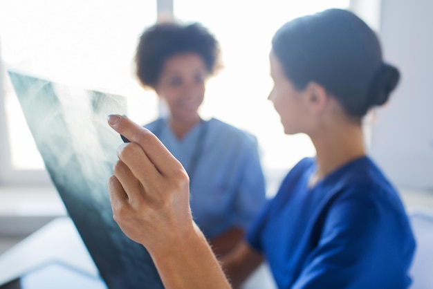 Photo concept de radiologie, de chirurgie, de personnes et de médecine - gros plan sur des femmes médecins heureuses regardant et discutant d'une image radiographique à l'hôpital