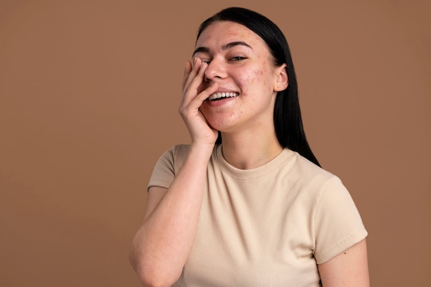 Confiante jeune femme avec l'acné