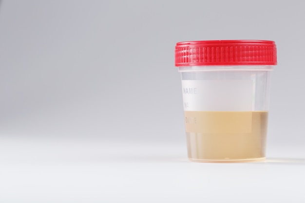 Conteneur avec tests d'urine médicaux