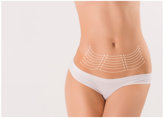 Corps féminin avec les flèches de dessin sur blanc. Concept de renforcement et de levage par fils