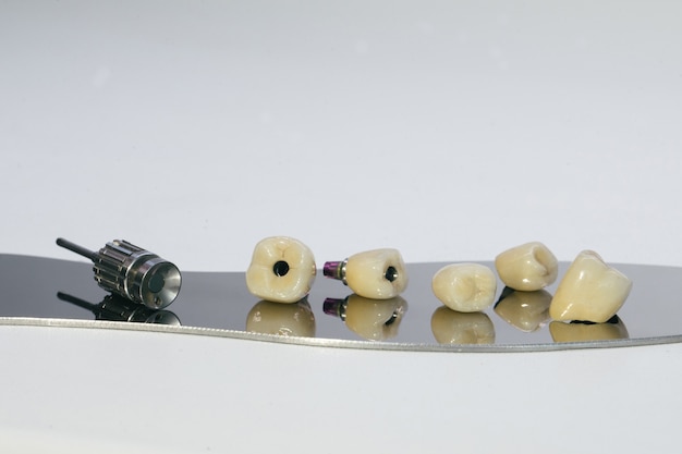 Photo couronne en zirconium et pilier hybride en zirconium. couronne monolithique vissée en zirconium sur l'implant, une vis et une clé manuelle pour visser la couronne.