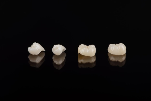 Couronnes anatomiques en céramique et en zircone qualifiées de dents humaines gros plan macro isolées sur noir