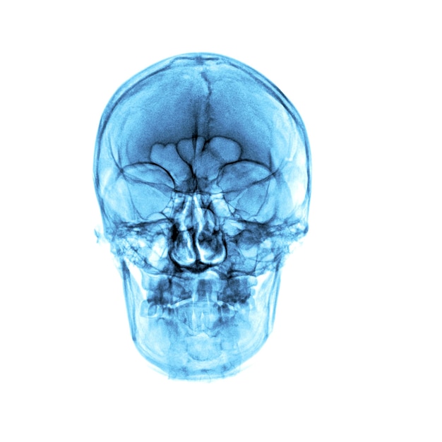 Un crâne humain bleu est représenté sur un fond blanc