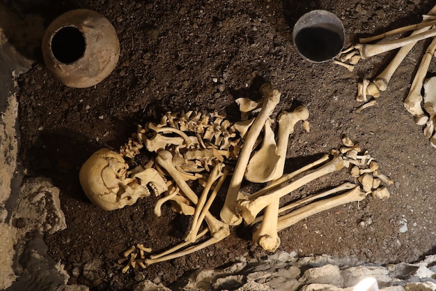 Un crâne et des os déterrés dans une fosse dans le cimetière effrayant des prisonniers.