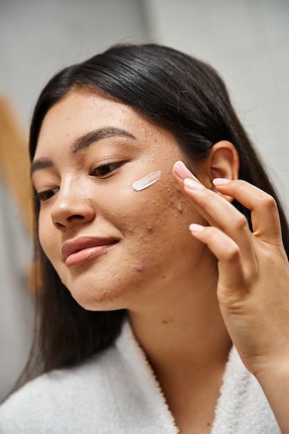 crème de traitement de l'acné sur le visage d'une jeune femme asiatique aux cheveux bruns qui regarde de près