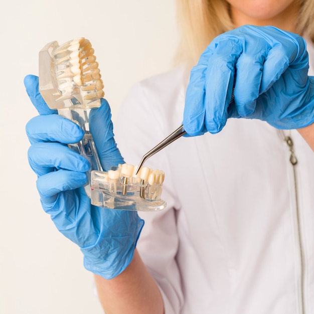 Le dentiste démontre des problèmes avec les dents sur l'exemple de la disposition de la mâchoire