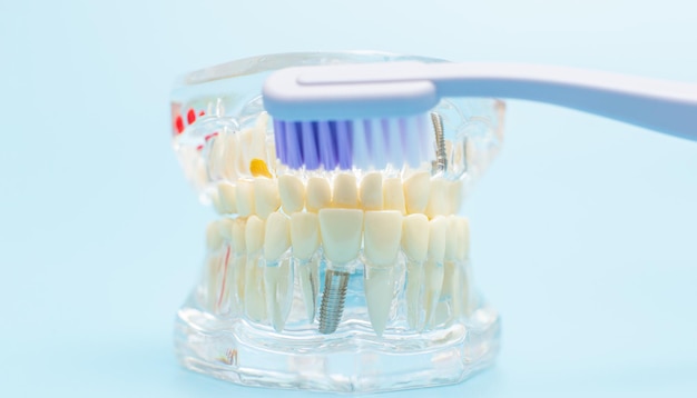 Dentiste dents prothétiques dentaires gencives racines gros plan Étudier le concept de maladies dentaires