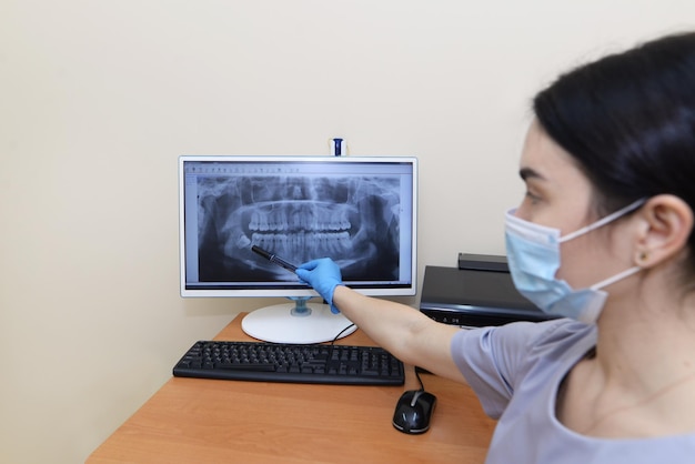 Le dentiste montre au patient une image radiographique sur le moniteur