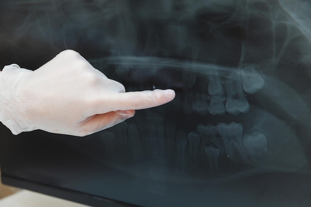 Le dentiste montre au patient une petite fille une radiographie des dents sur l'ordinateur
