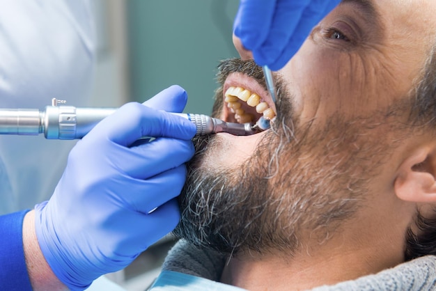 Le dentiste nettoie les dents du patient avec la bouche ouverte meilleur hôpital dentaire