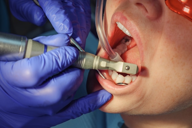 Dentiste traitant les dents d'une patiente en clinique, gros plan