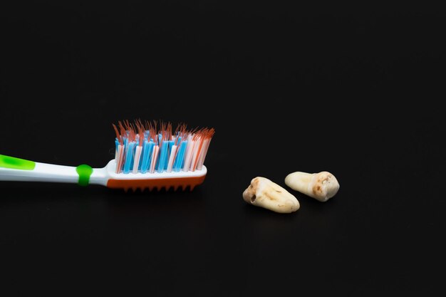 Photo dents caries endommagées avec brosse à dents sur fond noir