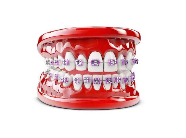 Dents avec crochets, illustration 3d du concept de soins dentaires.