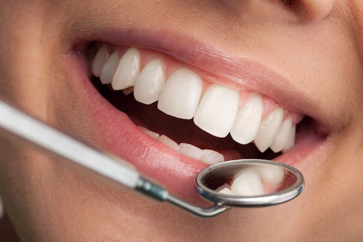 Photo dents de femme et miroir de bouche de dentiste sur fond, gros plan