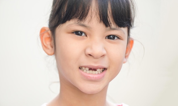Dents de lait perdues dents de bébé perdues sourire visage d'une enfant fille dents de bébé de la perte de dents sa dent de lait est tombée et sa dent permanente croissante dans la bouche ouverte concept de problèmes de santé dentaire