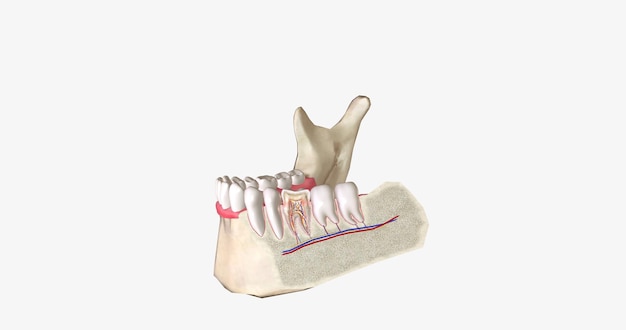 Les dents sensibles sont une affection dentaire courante caractérisée par une douleur dentaire aiguë