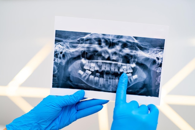 Dents soins de santé xray traitement dentisterie xray image examen