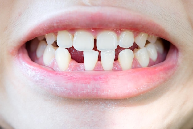 Photo depuis qu'elle est née, il lui manque des dents.