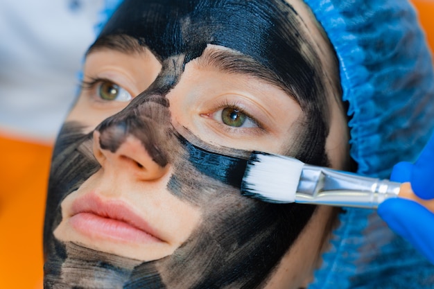 Le dermatologue étale un masque noir sur le visage pour le photorajeunissement au laser et le peeling au carbone. Dermatologie et cosmétologie. Utilisation d'un laser chirurgical.