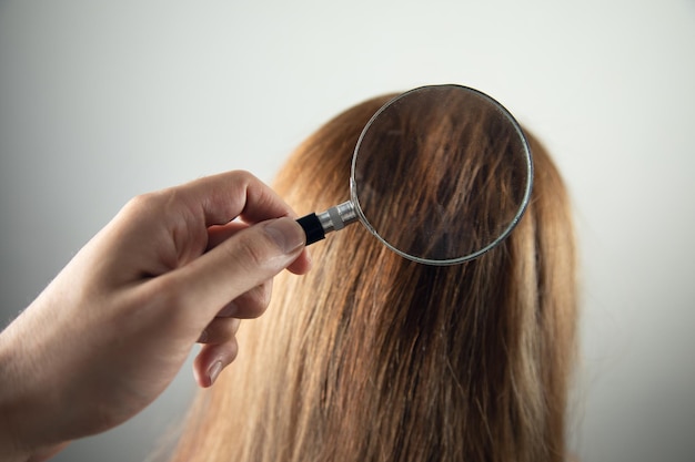 Dermatologue main examinant les cheveux de la femme avec une loupe