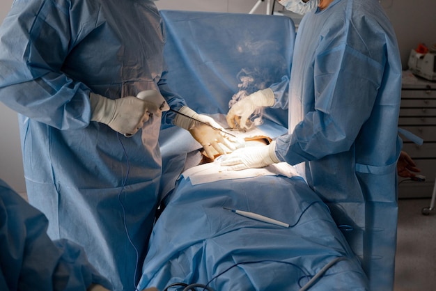 Deux chirurgiens opèrent la région abdominale d'un patient