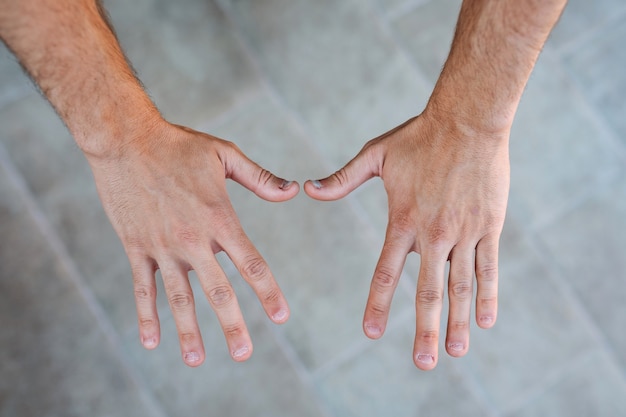 Deux mains de jeune homme avec des ongles moches et mordus