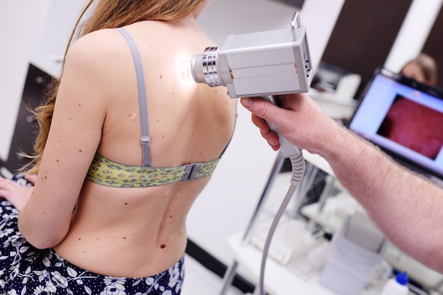 Diagnostic De Mélanome. Examen Des Taches De Naissance Et Des Grains De Beauté. Le Médecin Examine Le Grain De Beauté Du Patient