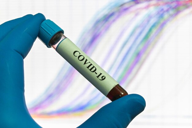 Diagnostic PCR COVID19