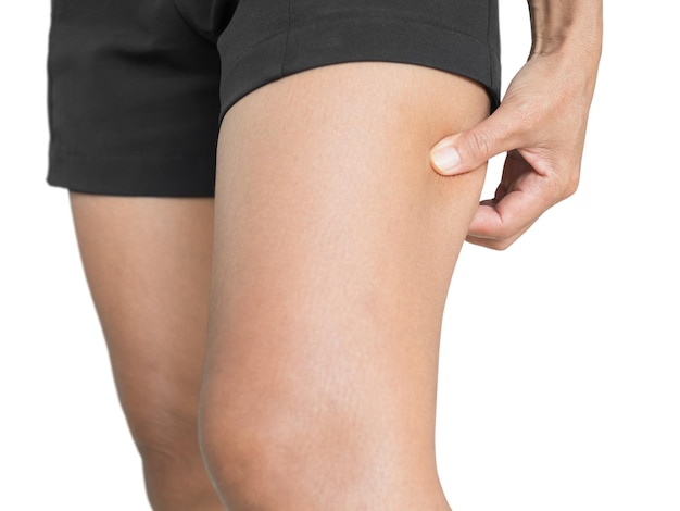 Diète forme du corps mince femme parfaite elle soulevant couche de cellulite peau d'orange sur la cuisse jambe peau bronzée sur fond blanc jeune sans graisse pour le traitement massage liposuction concept de soin du poids obèse