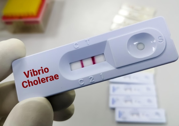 Le dispositif de test rapide ou la cassette pour le test Vibrio cholerae montrent un résultat positif.