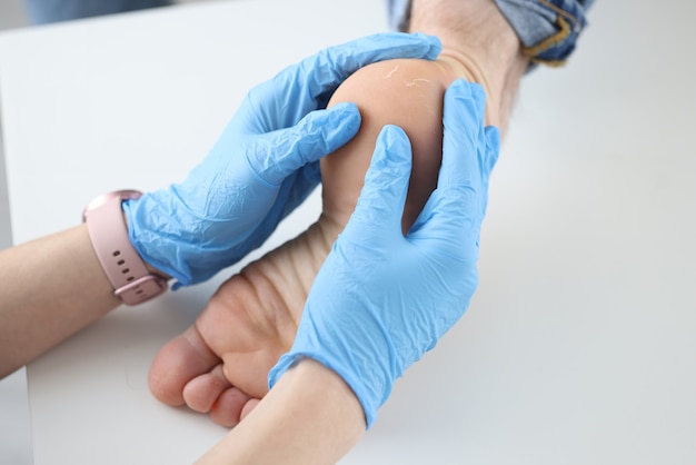 Docteur dermatologue en gants examinant les patients talon gros plan. Traitement des talons fissurés